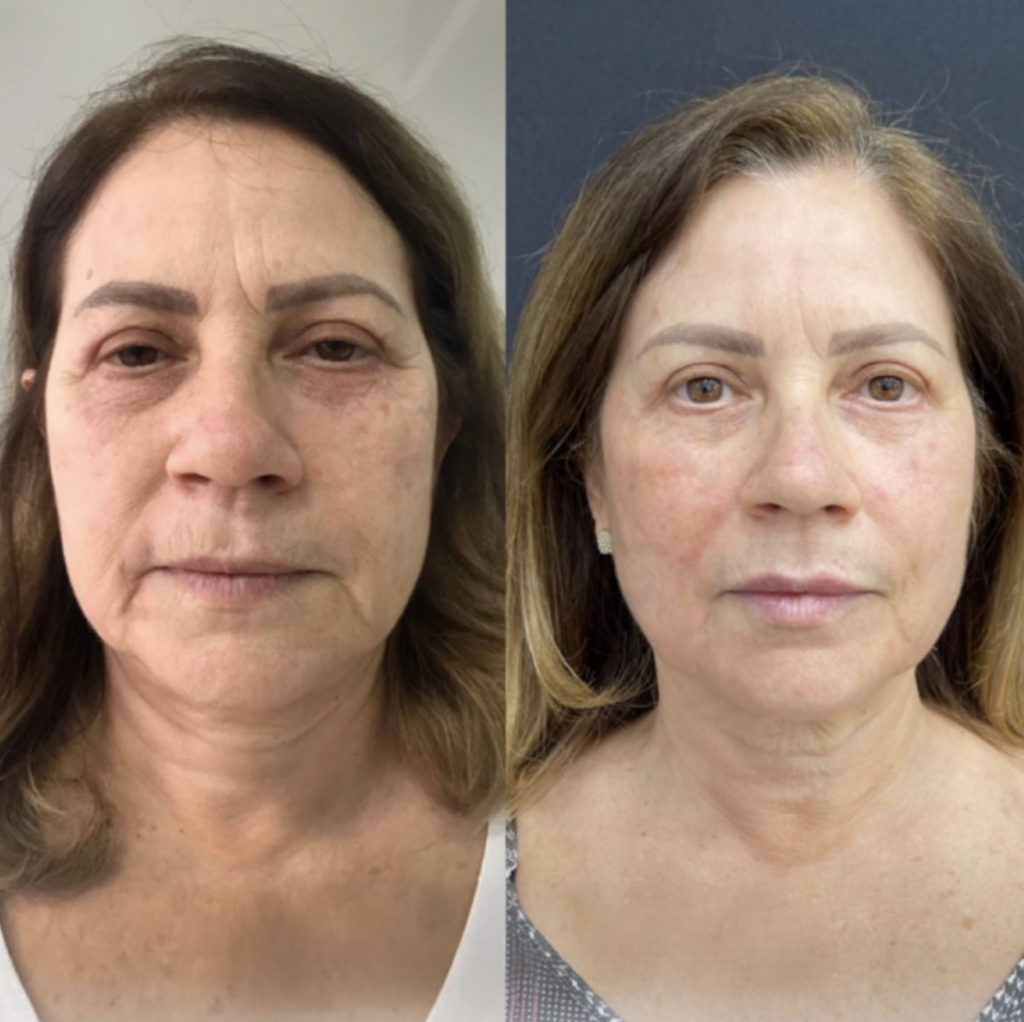 Captura de Tela 2024-12-17 às 11.10.48