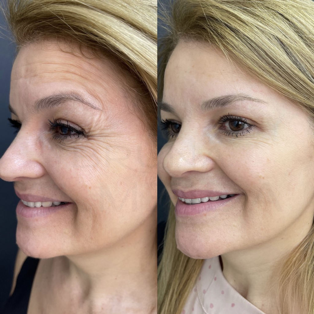 Captura de Tela 2025-01-13 às 13.21.04