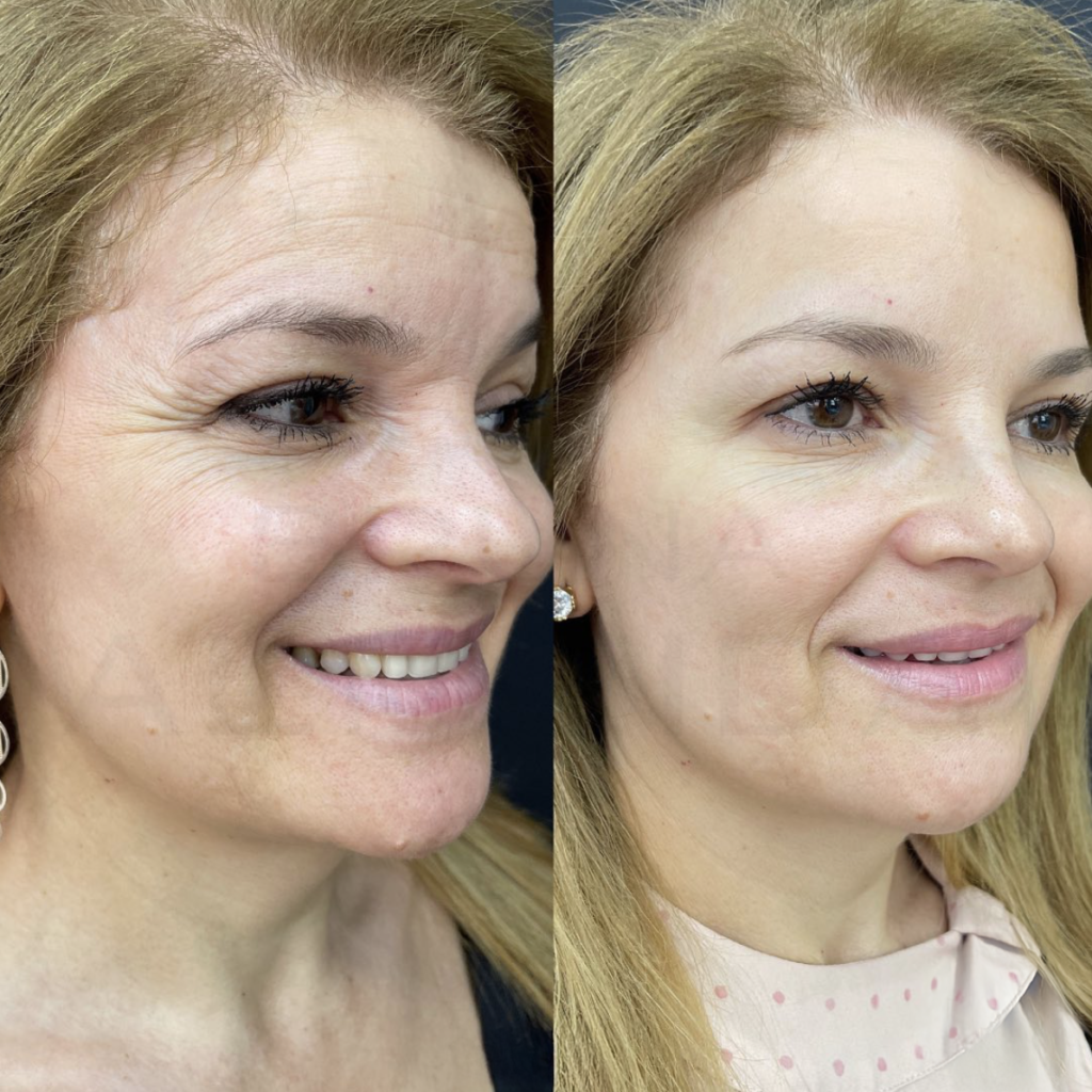 Captura de Tela 2025-01-13 às 13.21.16